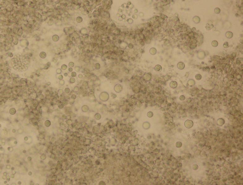 qpxin tissue